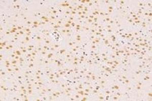 Immunohistochemistry analysis of paraffin-embedded rat tsubstantia nigra using SUN2 (ABIN7075502) at dilution of 1: 4000 (SUN2 antibody)