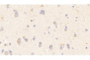 Detection of WASP in Human Cerebrum Tissue using Polyclonal Antibody to Wiskott Aldrich Syndrome Protein (WASP) (WASP antibody  (AA 39-251))