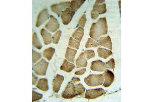 RVA Antibody (C-term) (ABIN653266 and ABIN2842784) IHC analysis in formalin fixed and raffin embedded human skeletal muscle tissue followed by peroxidase conjugation of the secondary antibody and DAB staining. (Parvin alpha antibody  (C-Term))