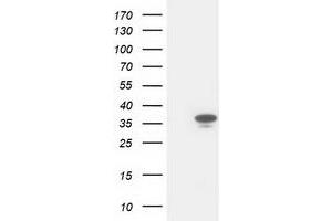 Western Blotting (WB) image for anti-Cyclin-Dependent Kinase 2 (CDK2) antibody (ABIN1497397) (CDK2 antibody)
