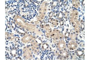 GPR161 antibody was used for immunohistochemistry at a concentration of 4-8 ug/ml to stain Epithelial cells of renal tubule (arrows) in Human Kidney.