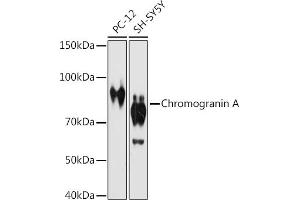 Western blot analysis of extracts of various cell lines, using Chromogranin A antibody (ABIN7266366) at 1:1000 dilution. (Chromogranin A antibody)
