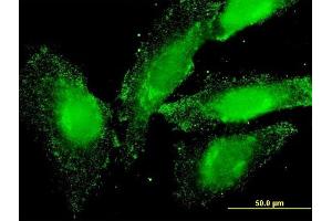 Immunofluorescence of monoclonal antibody to ELA2 on HeLa cell. (ELANE antibody  (AA 168-267))