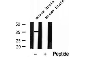 Western blot analysis of extracts of mouse brain tissue, using LDHB antibody.