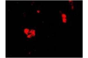 Immunocytochemistry of CIDE-B in Human Small Intestine cells with CIDE-B antibody at 20 ug/ml (CIDEB antibody  (C-Term))