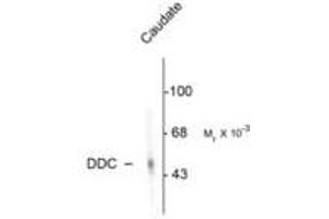 Image no. 1 for anti-Dopa Decarboxylase (Aromatic L-Amino Acid Decarboxylase) (DDC) antibody (ABIN220954) (DDC antibody)