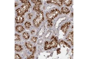 Immunohistochemical staining (Formalin-fixed paraffin-embedded sections) of human kidney with SLC22A11 polyclonal antibody  shows distinct membranous positivity in tubular cells. (SLC22A11 antibody)