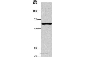 Western blot analysis of Mouse testis tissue, using ARMCX2 Polyclonal Antibody at dilution of 1:425
