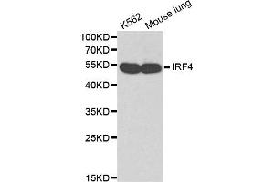 Western blot analysis of K562 cell lines and mouse lung using IRF4 antibody. (IRF4 antibody)