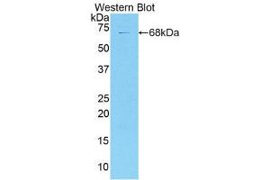 Western Blotting (WB) image for anti-Collagen, Type XVIII (COL18) (AA 1072-1271) antibody (ABIN1858450) (COL18 antibody  (AA 1072-1271))