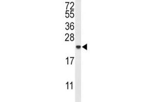 Western blot analysis of IL-10 antibody and MDA-MB435 lysate. (IL-10 antibody  (AA 27-53))
