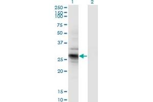 Western Blot analysis of IDI2 expression in transfected 293T cell line by IDI2 monoclonal antibody (M01), clone 1C11.