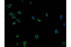 Immunofluorescence staining of HepG2 cells with ABIN7139976 at 1:100, counter-stained with DAPI. (OR2A7 antibody  (AA 258-273))