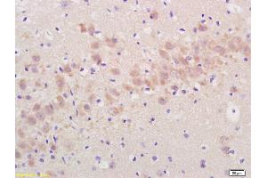 Formalin-fixed and paraffin embedded rat brain labeled with Rabbit Anti Annexin A13 Polyclonal Antibody, Unconjugated (ABIN724250) at 1:200 followed by conjugation to the secondary antibody and DAB staining (ARTN antibody  (AA 101-170))