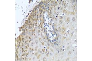 Immunohistochemistry of paraffin-embedded human esophagus using CYPOR antibody (ABIN6130227, ABIN6145969, ABIN6145970 and ABIN7101824) at dilution of 1:100 (40x lens). (POR antibody  (AA 1-250))