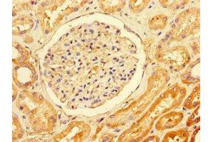 Immunohistochemistry of paraffin-embedded human kidney tissue using ABIN7171701 at dilution of 1:100 (TTI1 antibody  (AA 692-858))