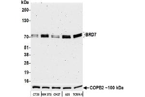 Western Blotting (WB) image for anti-Bromodomain Containing 7 (BRD7) (AA 150-200) antibody (ABIN7449350) (Recombinant BRD7 antibody  (AA 150-200))