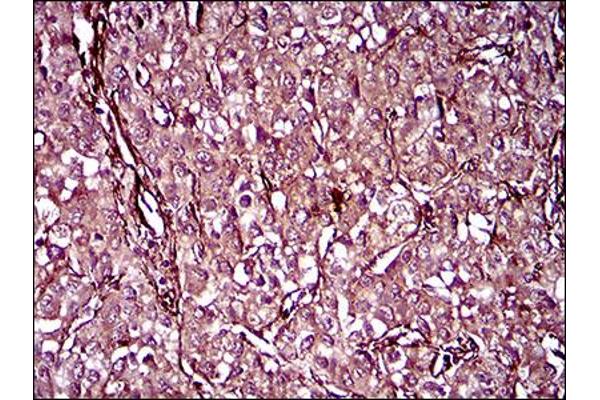 MCAM antibody  (AA 84-189)