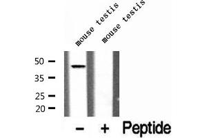 Western blot analysis of extracts of mouse testis tissue, using ADRM1 antibody. (ADRM1 antibody  (Internal Region))