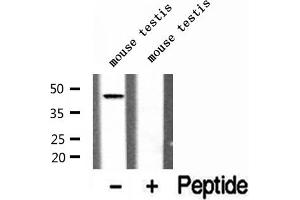 Western blot analysis of extracts of mouse testis tissue, using ADRM1 antibody.