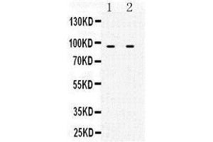 Observed bind size: 91KD (MCM3 antibody  (N-Term))