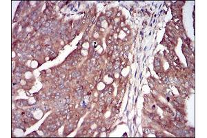 Immunohistochemistry (IHC) image for anti-Eukaryotic Translation Initiation Factor 2-alpha Kinase 2 (EIF2AK2) (AA 329-551) antibody (ABIN2682988)