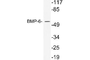 Western blot (WB) analysis of BMP-6 antibody in extracts from 293 cells treated with TNF. (BMP6 antibody)