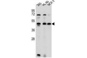 ANKRD40 Antibody (C-term) western blot analysis in 293,HL-60,MCF-7 cell line lysates (35µg/lane). (ANKRD40 antibody  (C-Term))