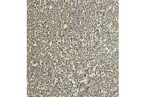 IHC analysis of CD69 using anti-CD69 antibody (ABIN7599623). (CD69 antibody  (AA 101-148))