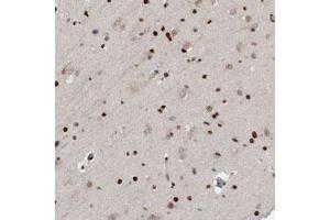Immunohistochemical staining of human cerebral cortex with ZEB1 polyclonal antibody  shows strong nuclear positivity in glial cells at 1:500-1:1000 dilution.