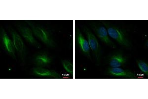 ICC/IF Image PDLIM4 antibody [C2C3], C-term detects PDLIM4 protein at cytoplasm by immunofluorescent analysis. (PDLIM4 antibody  (C-Term))