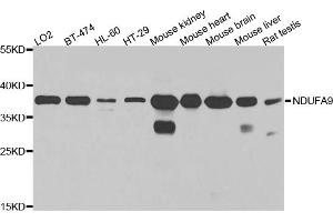 Western blot analysis of extracts of various cell lines, using NDUFA9 antibody. (NDUFA9 antibody)