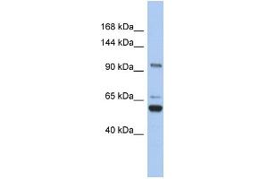 WB Suggested Anti-TRPM8 Antibody Titration:  0. (TRPM8 antibody  (N-Term))