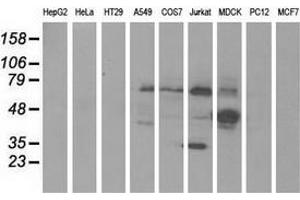 Western blot analysis of extracts (35 µg) from 9 different cell lines by using anti-KLHL2 monoclonal antibody. (KLHL2 antibody  (AA 1-100, AA 494-593))