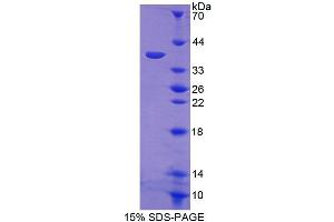 SDS-PAGE (SDS) image for Protein Phosphatase 6, Catalytic Subunit (PPP6C) (AA 3-305) protein (His tag) (ABIN4990155)