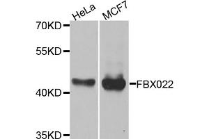 Western blot analysis of extracts of various cell lines, using FBXO22 antibody. (FBXO22 antibody)