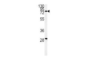Western blot analysis of ZFYVE16 Antibody (N-term) (ABIN651313 and ABIN2840182) in K562 cell line lysates (35 μg/lane). (ZFYVE16 antibody  (N-Term))