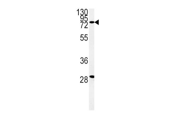 ZFYVE16 anticorps  (N-Term)