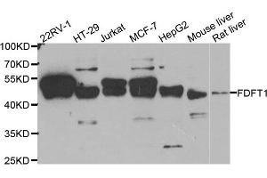 Western Blotting (WB) image for anti-Farnesyl-Diphosphate Farnesyltransferase 1 (FDFT1) antibody (ABIN1882356)