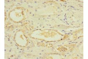 Immunohistochemistry of paraffin-embedded human kidney tissue using ABIN7174375 at dilution of 1:100 (UBE4A antibody  (AA 797-1066))