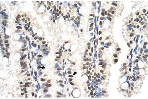 Human Intestine (SNX29 antibody  (N-Term))
