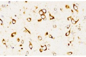 Immunohistochemistry of paraffin-embedded Rat brain using LAMP3 Polyclonal Antibody at dilution of 1:200 (40x lens).