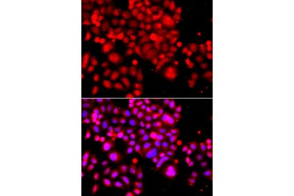 ASCC3 antibody  (AA 1-111)