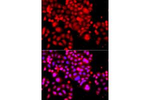 Immunofluorescence analysis of  cells using  antibody (ABIN6133295, ABIN6137172, ABIN6137173 and ABIN6223966). (ASCC3 antibody  (AA 1-111))