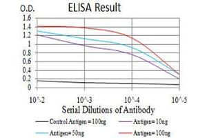 Black line: Control Antigen (100 ng), Purple line: Antigen(10 ng), Blue line: Antigen (50 ng), Red line: Antigen (100 ng), (Histone Cluster 2, H3c (HIST2H3C) (acLys27) antibody)
