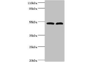 Western blot All lanes: Protein FAM114A2 antibody at 2 μg/mL Lane 1: Mouse kidney tissue Lane 2: U251 whole cell lysate Secondary Goat polyclonal to rabbit IgG at 1/10000 dilution Predicted band size: 55 kDa Observed band size: 55 kDa (FAM114A2 antibody  (AA 1-505))