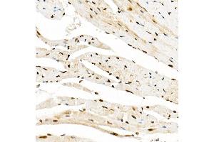 Immunohistochemistry (IHC) image for anti-K(lysine) Acetyltransferase 2A (KAT2A) (AA 1-100) antibody (ABIN1679964)