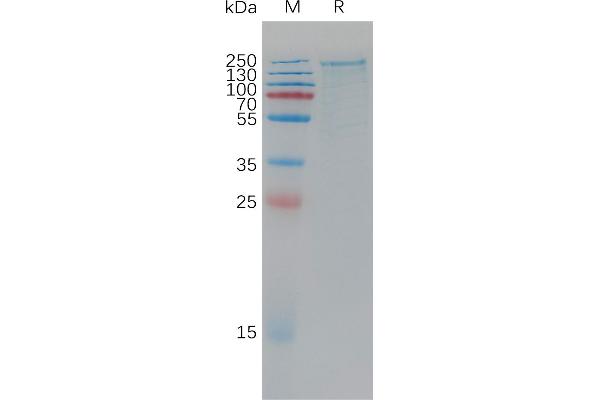 LRP6 Protein (AA 20-1370) (His tag)