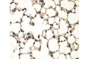 Immunohistochemistry of paraffin-embedded Mouse lung using PHF11 Polyclonal Antibody at dilution of 1:100 (40x lens). (PHF11 antibody)