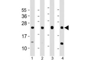 Western blot testing of human 1) A431, 2) HeLa, 3) HepG2 and 4) MCF-7 cell lysate with LITAF antibody at 1:1000. (LITAF antibody  (AA 31-60))